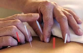 Cefisa – Clinica Especializada De Fisioterapia E Acupuntura - Foto 1